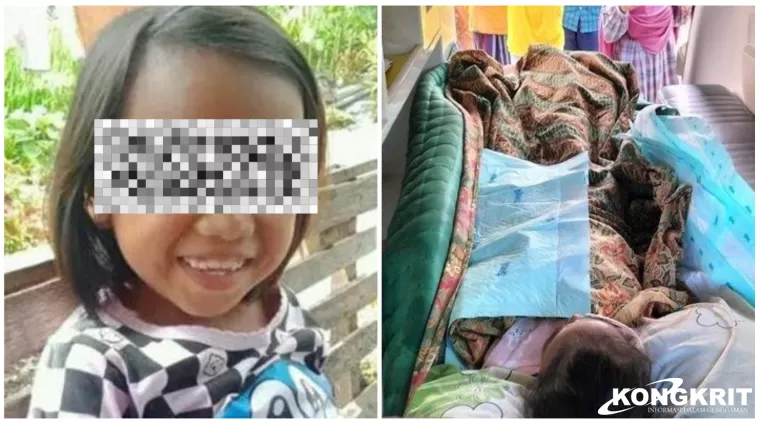 5 Fakta Tragis Adelia Rahma, Siswi SD di Pariaman yang Meninggal Usai Disiram Bensin Oleh Teman