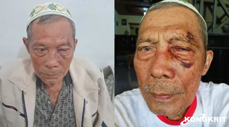 Lansia 90 Tahun Dikeroyok di Simalidu, Salah Satu Pelaku Diduga Seorang Pengajar di SMP Negeri Tebo