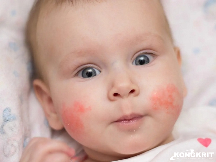 Bayi Minum Susu Kedelai, Bolehkah? Berikut Penjelasannya. (Foto : Dok. Istimewa)