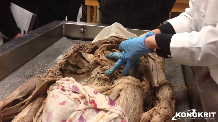 Mengenal Cadaver Sang  &quot;Guru Besar&quot; dalam Box di Parkiran UNPRI Medan (Foto : Dok. Istimewa)