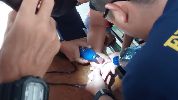 Petugas memotong cincin di jari yang melekat di jari seorang mahasiswa dengan menggunakan mesin gerinda. (Foto: Dok. Dinas Damkar Padang)